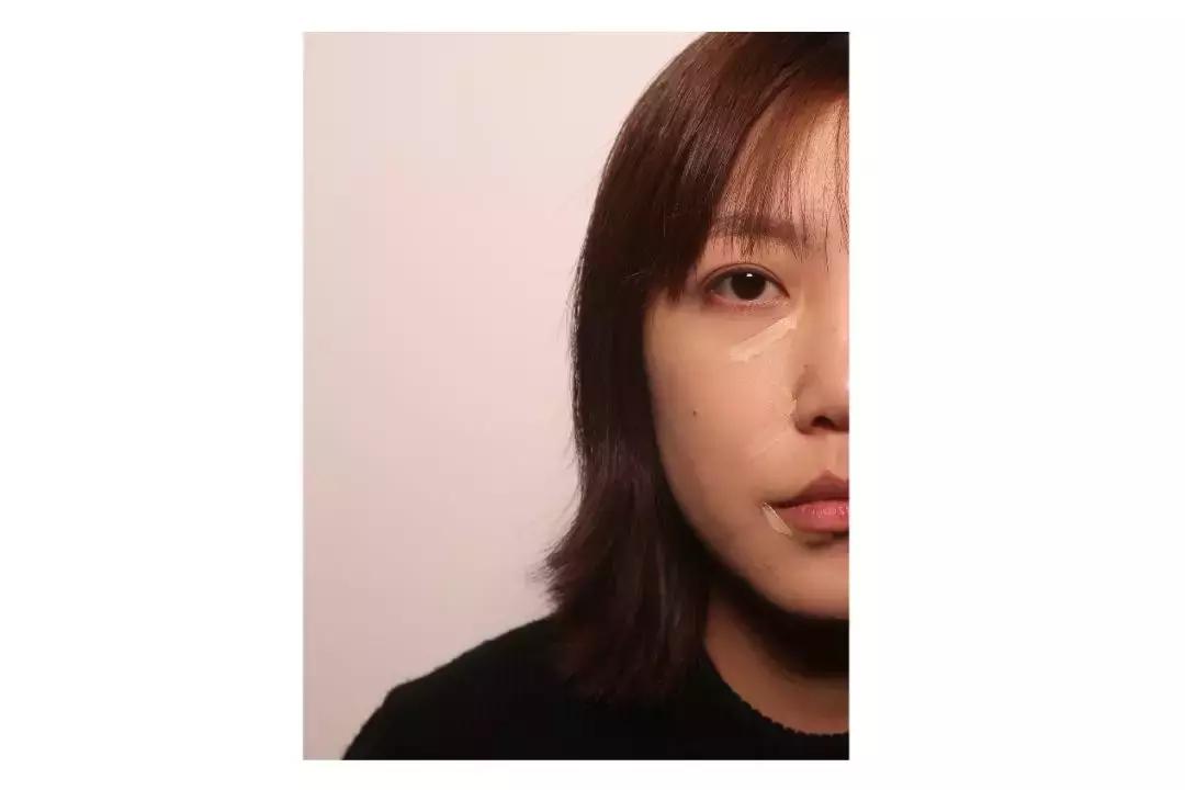 缇庡鐨偆绠＄悊鍖栧,缇庡闄㈠仛鑲岃偆閬憰