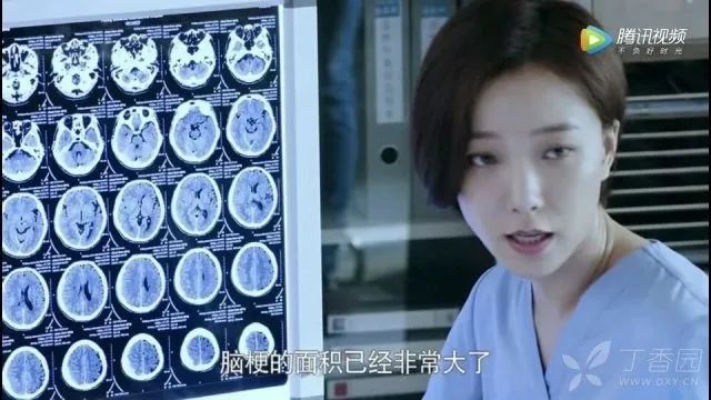 治疗脑梗死输什么液体最好,亚急性脑梗死怎么治疗最好