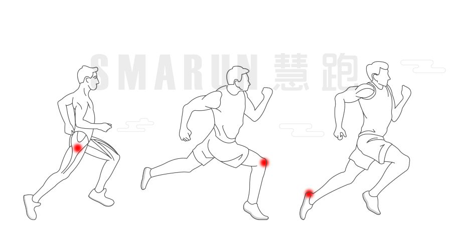 跑者足底力量训练动作,跑者足底疼痛怎么有效解决