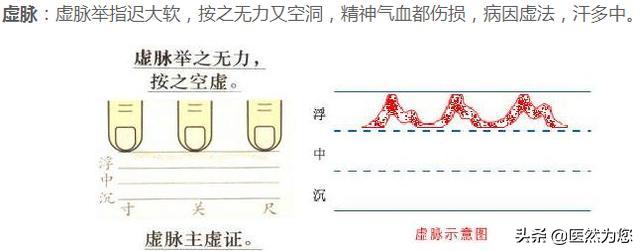 脉象动态图,脉象动图
