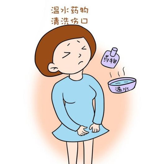 不同种类的产褥期护理,卫生部产褥期护理视频