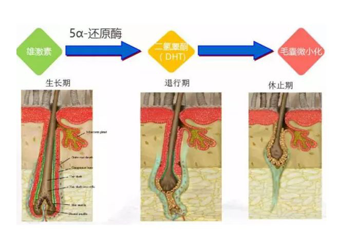 吃什么能使头发变得乌黑又浓密,吃什么可以使头发浓密