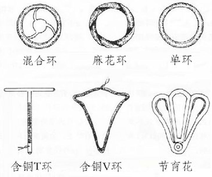 宫内节育器和节育环有什么区别,宫内节育器避孕环