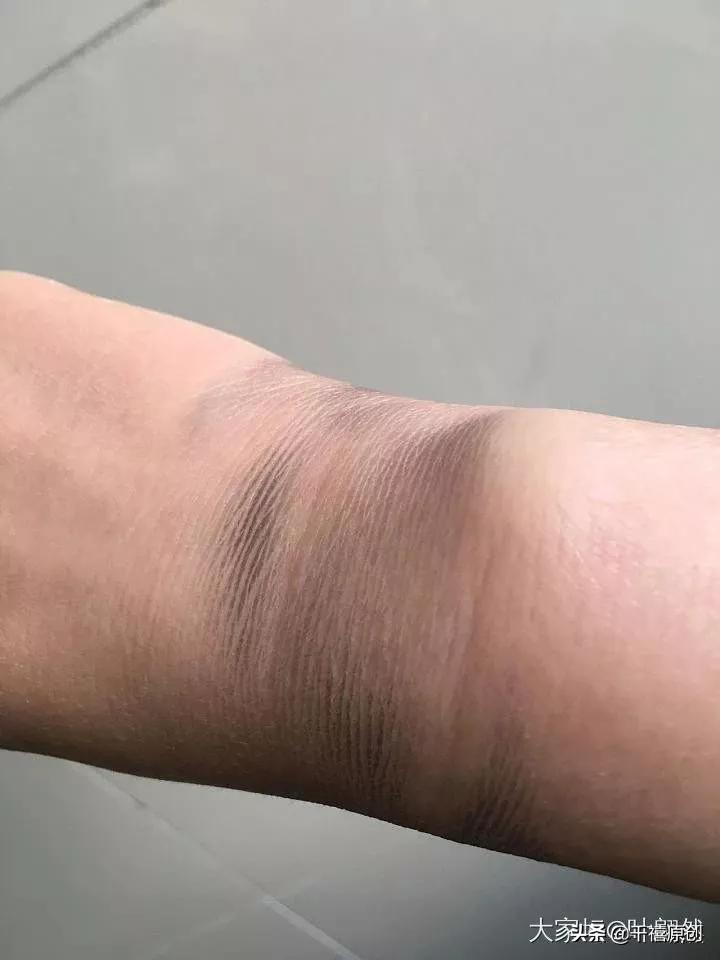 银镯里面发黑,戴银镯手腕发黑是怎么回事
