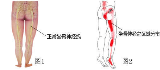 老年人骨质疏松需要长久吃钙片吗,老年人腿疼骨质增生可以吃钙片吗