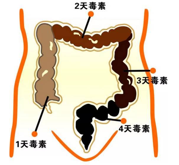 顽固便秘吃什么最快通便,长期便秘怎么办教你四招轻松改善