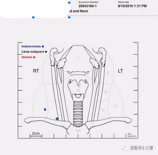甲状腺癌术后8个月复发能活多久,甲状腺癌术后复发做131有用吗