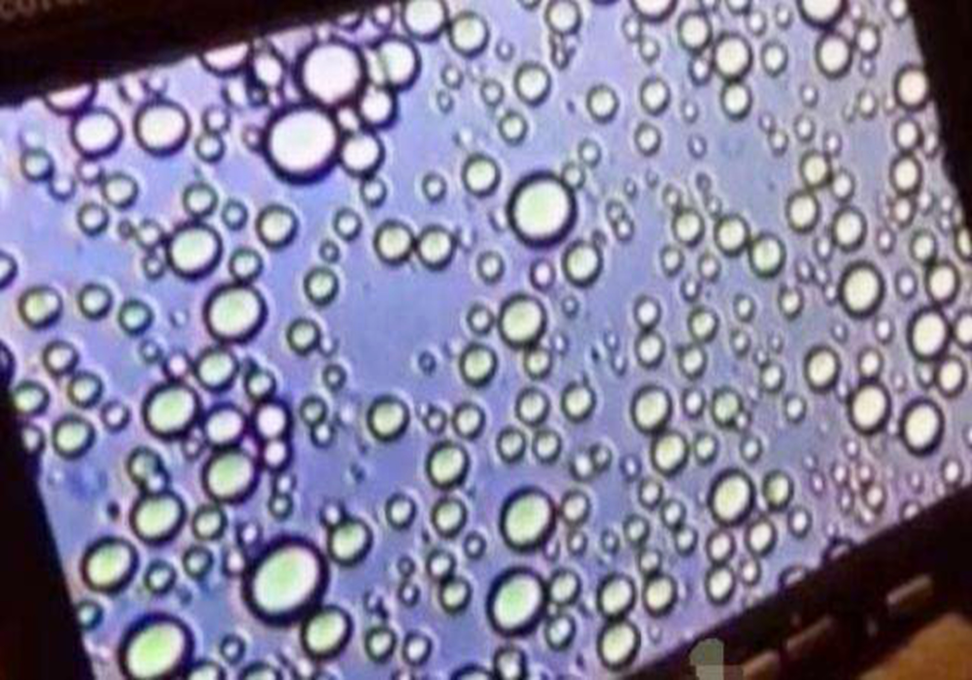母乳放大100倍原来真的是血做的,母乳在显微镜下被放大1000倍
