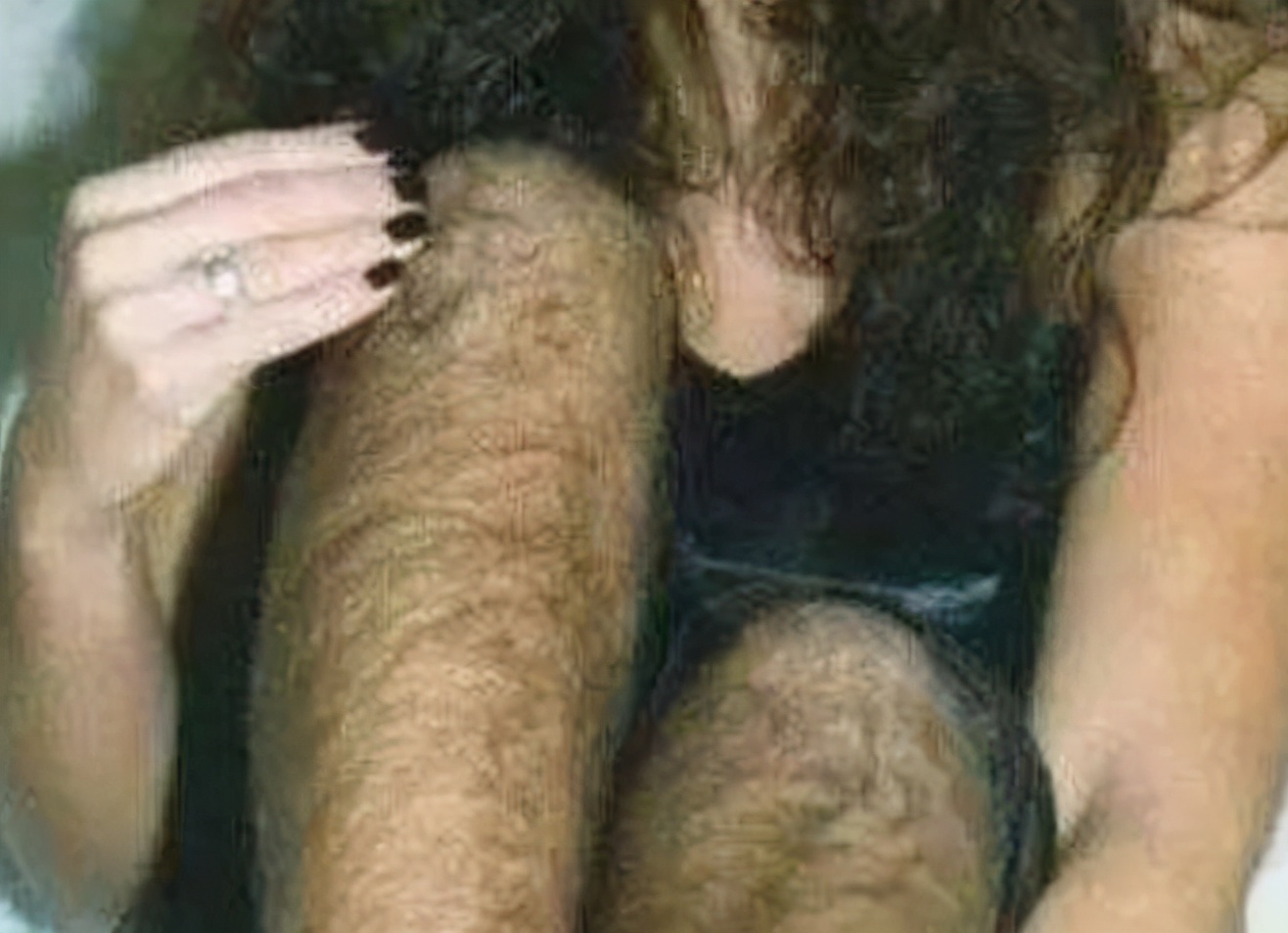 女子浑身长毛发,女子全身长毛发