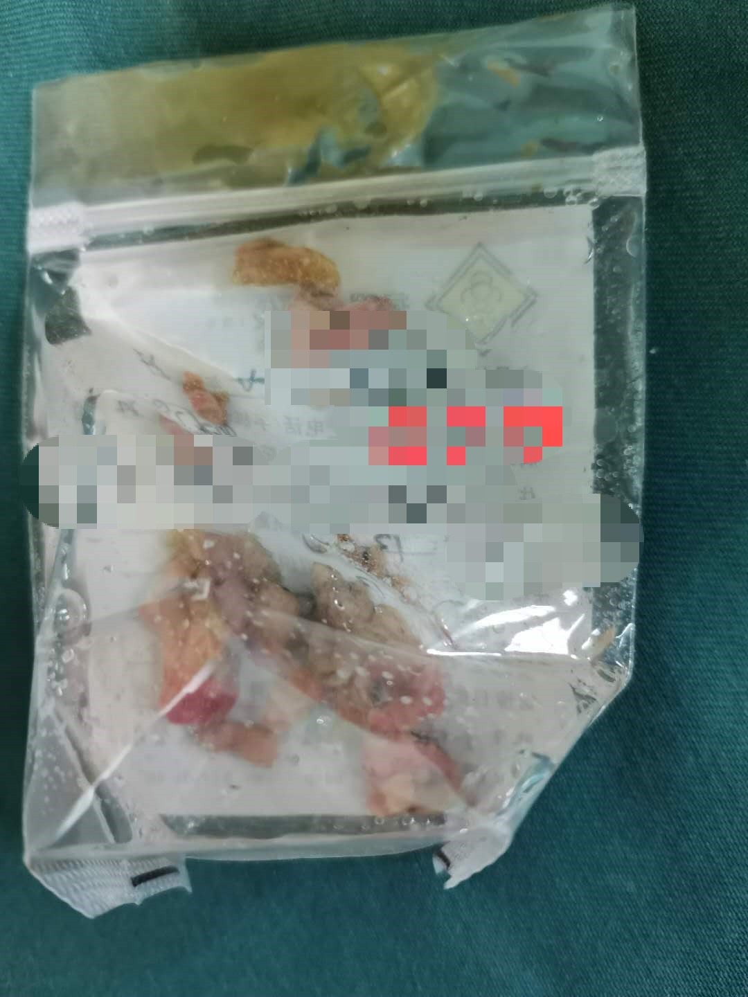 备孕日记：我在复兴医院做子宫内膜手术的日记