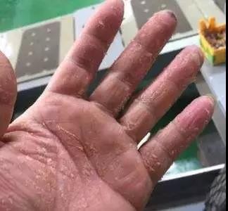 安发甘诺宝力的真实感受,安发国际甘诺宝力有权威吗