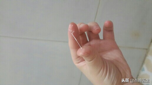 女性排卵不好能不能怀孕,如何判断自己是否正常排卵