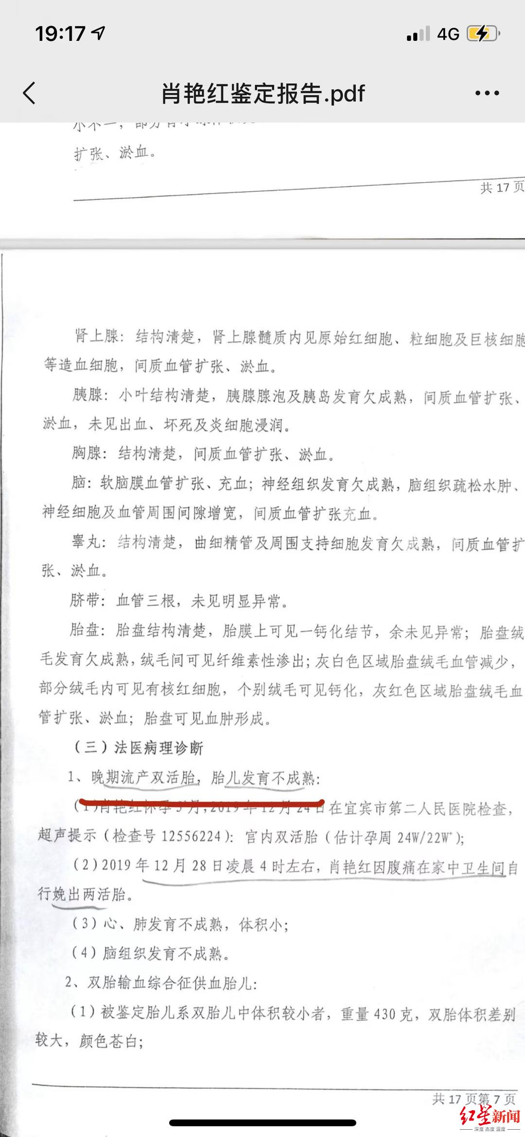 “双胞胎流产疑云”调查：孕妇腹痛医院做支架置入术两天后流产家属质疑诊疗不当索赔百万