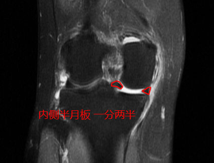 热爱跳舞的阿姨们,热爱广场舞的阿姨