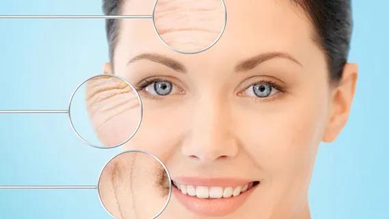 什么样的人适合做面部除皱术,关于面部除皱的常见问题有哪些