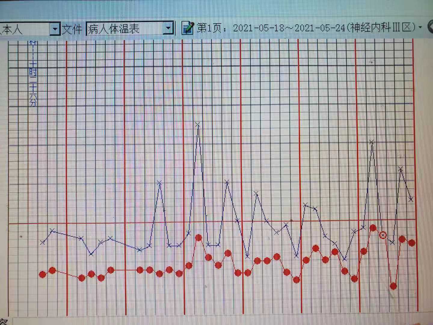 头痛反复高热,头痛低热二十多天是怎么回事