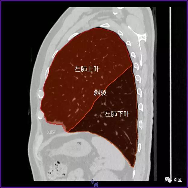 如此详细的肺部影像解剖，有点儿酷