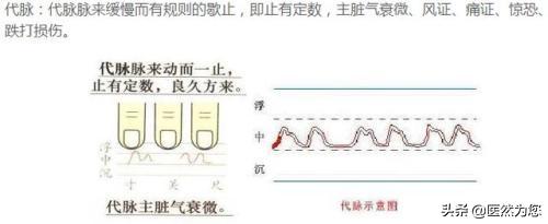 脉象动态图,脉象动图