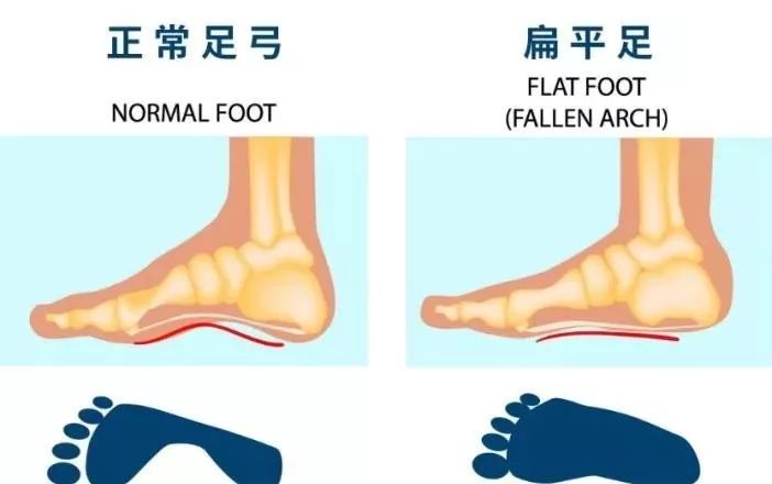 改变腿型和瘦腿的鞋子,显腿瘦增高鞋子