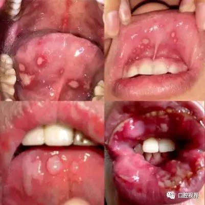 口腔科普咨询,口腔医院挂号预约流程