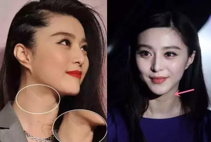 明星如何祛颈纹,女生颈纹很深该怎么解决