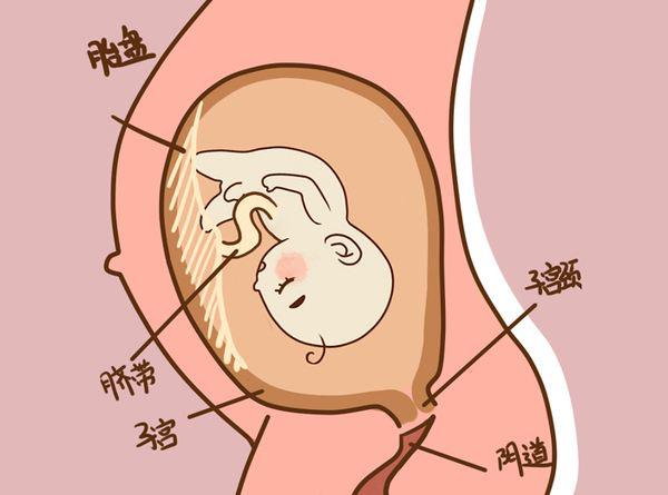 人工破胎膜会不会对胎儿有影响,胎膜早破指什么时候胎膜发生破裂