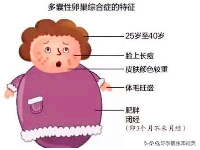 b超多囊卵巢的报告,激素正常b超显示卵巢多囊样改变