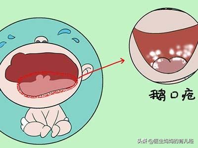 宝宝常见疾病及处理方法,宝宝的十个常见疾病