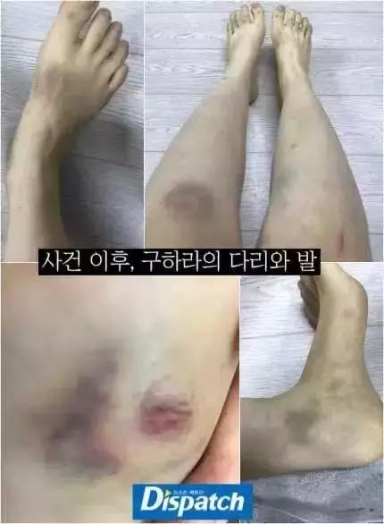 韩国女明星自杀之谜，性感*物尤**的悲剧人生
