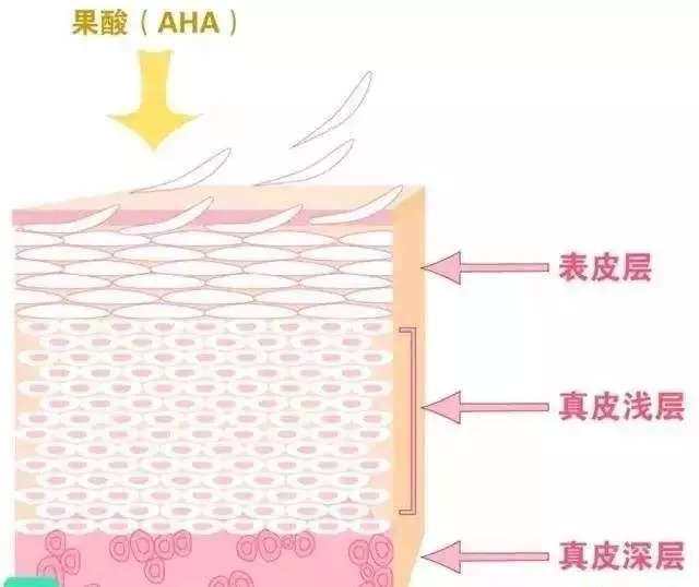 果酸换肤能改变肤质吗,果酸焕肤什么肤质适合