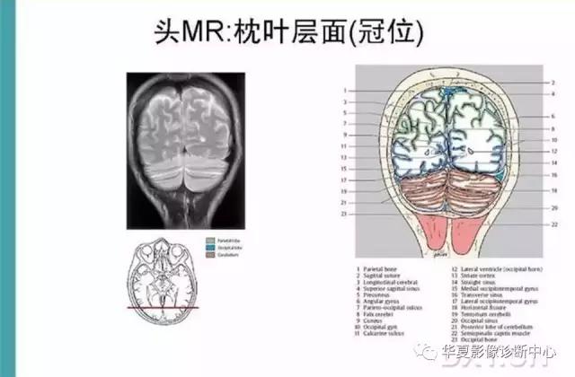 mra头颅解剖学详细讲解视频,常见的头颅mri图像