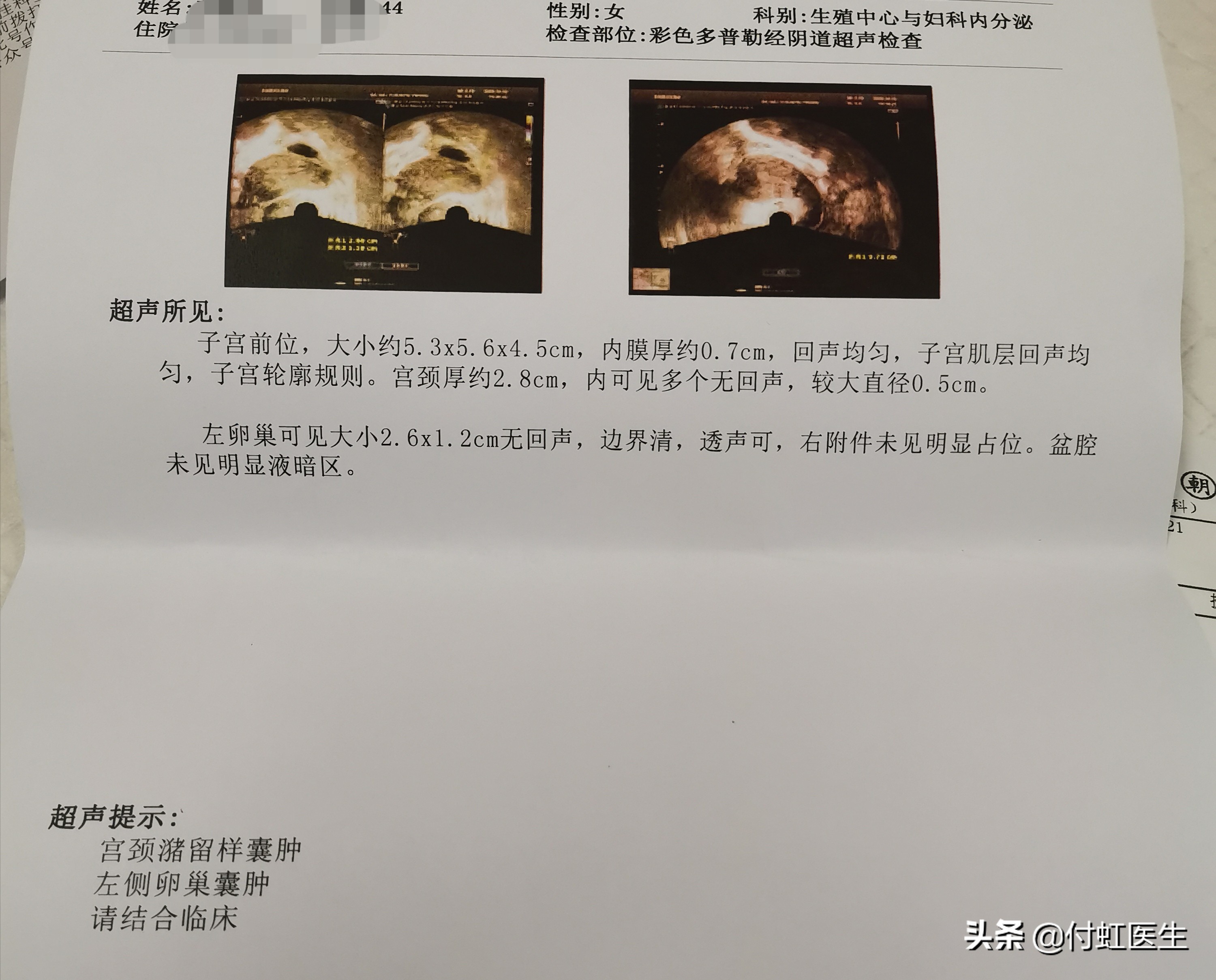人流术后月经来10几天不干净,人流术后三个月内膜薄例假不来