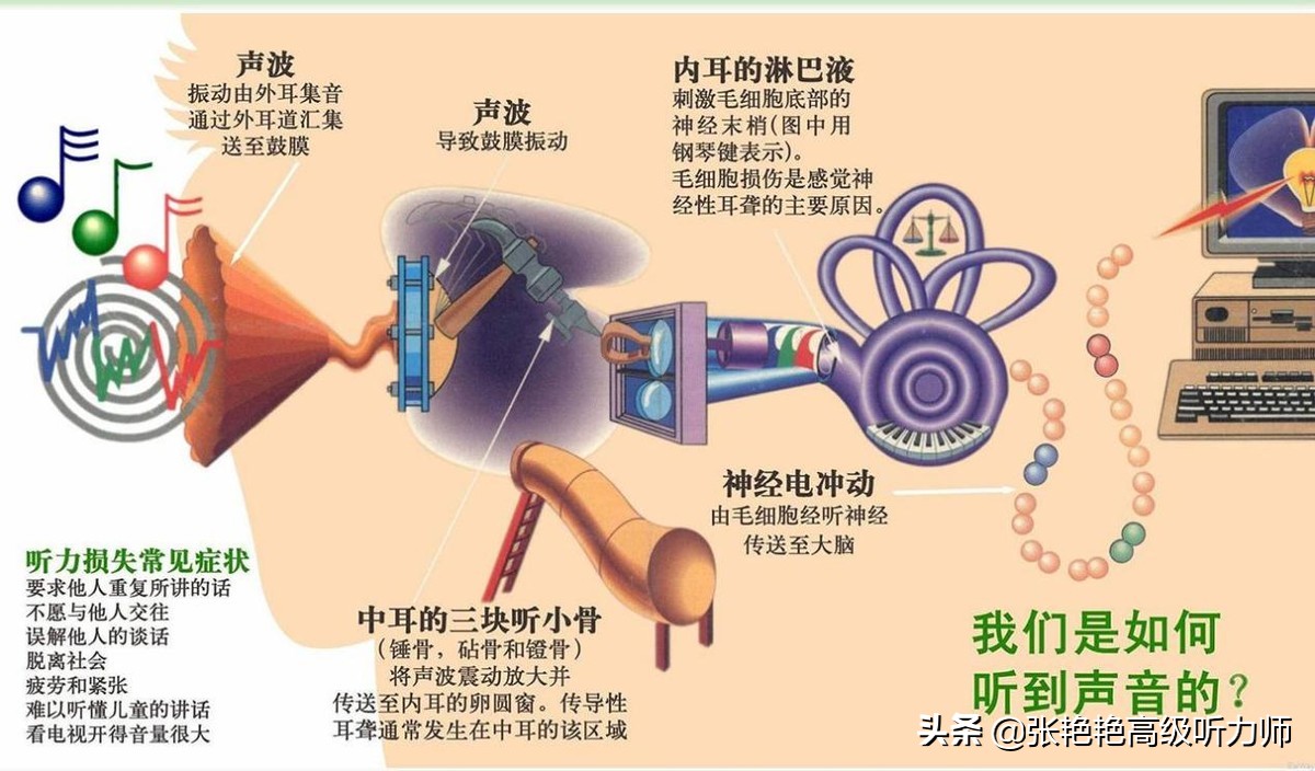 听力不好应该看什么科,听力不好选什么耳机
