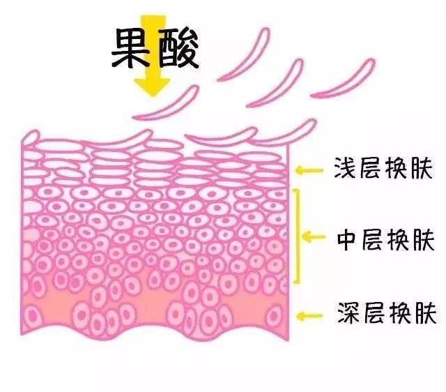 眼睛周围长特别痒小疙瘩怎么回事,女性眼睛周围长疙瘩是什么原因