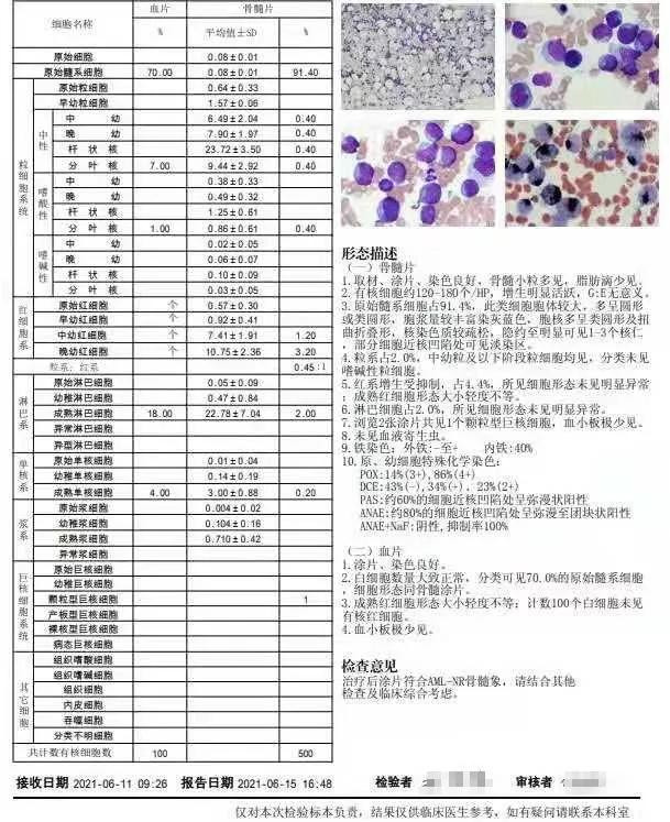 粒单不决问组化？有时还真不一定...