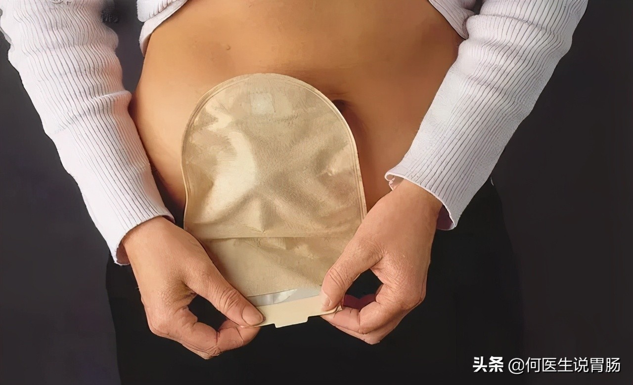 越来越多人因肠癌丧命,肛肠癌怎样缓解痛苦
