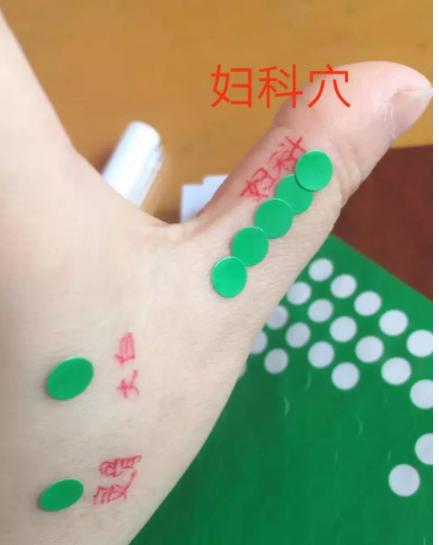 董氏奇穴两个穴位帮你解决妇科疾病