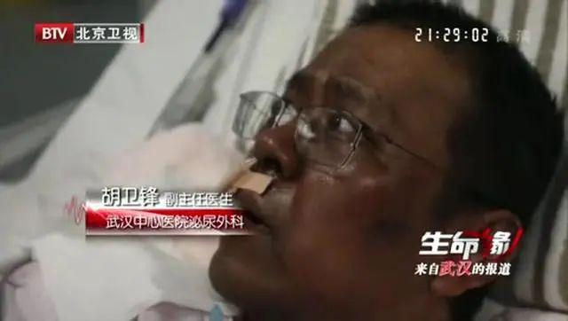 新冠后遗症厉害的视频,新冠后遗症重要器官损伤