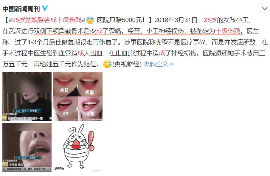 方脸怎么变成鹅蛋脸三种方法,如何判断自己是鹅蛋脸还是方脸