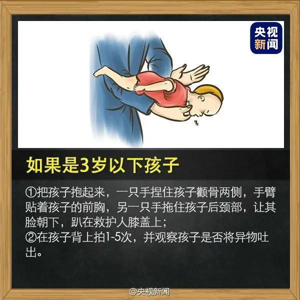 儿童异物卡喉梗阻窒息急救法,孩子被异物卡喉怎么做手术