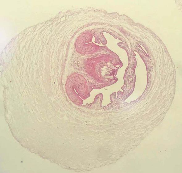 可怕！女子上臂鼓出个蚕豆大小的包，摸起来软软的，还会动！