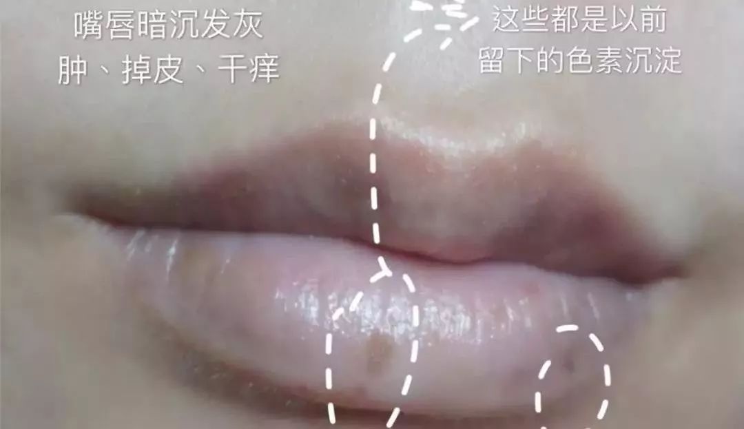 干裂救星护手霜,唇干裂用什么润唇好