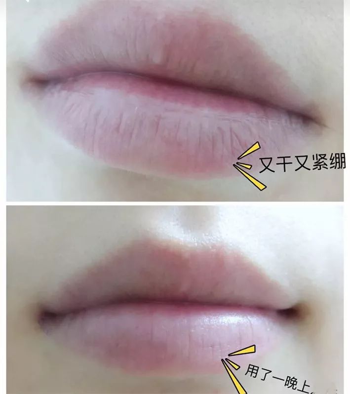 干裂救星护手霜,唇干裂用什么润唇好