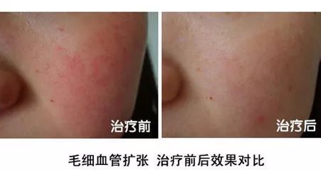 新年新气象从焕新开始,新年新气象开工好彩头