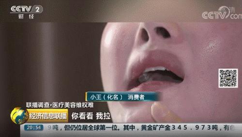 整容脸被打伤如何赔偿,整容10级伤残赔偿标准