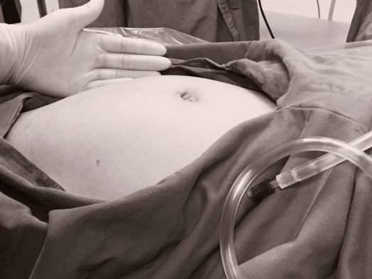 【义诊】有你才有我们，关注女性健康