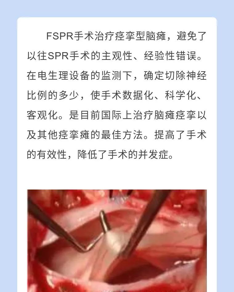四川八一康复中心脑瘫手术,江西省脑瘫康复中心