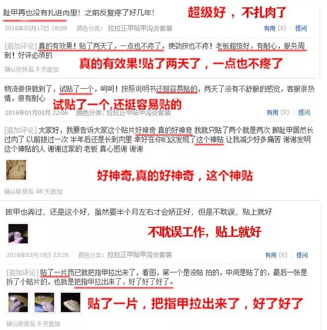 趾甲扎进肉里了，一碰就痛？用它一贴，1分钟止痛，趾甲往外长，再也不扎痛了！