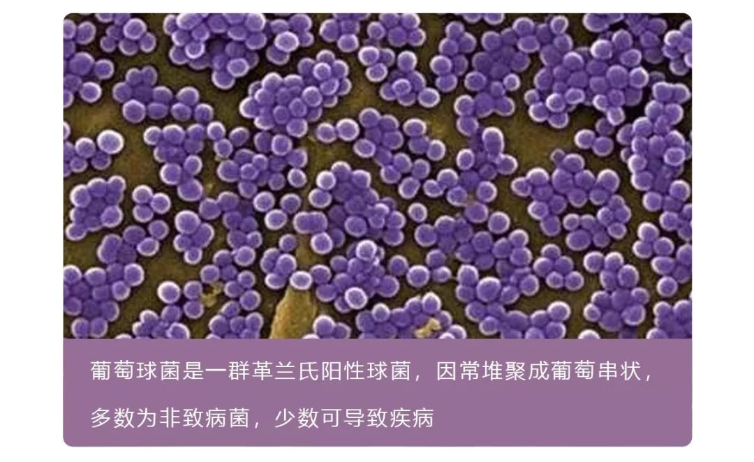 朋友有狐臭穿我的衣服会不会传染,女朋友有狐臭会传染吗