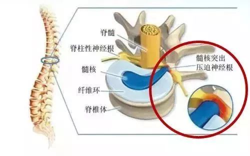 老年人补着钙还抽筋怎么处理,中老年人抽筋不能吃什么
